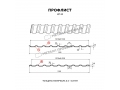 Профлист Металл Профиль МП-20x1100-R (PURETAN-20-8017-0,5)